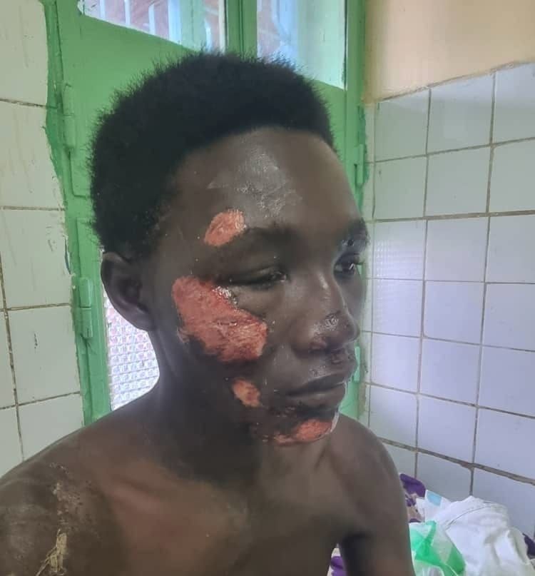 Tchad : un père dénonce l'insécurité après l'agression de son fils près du camp 27